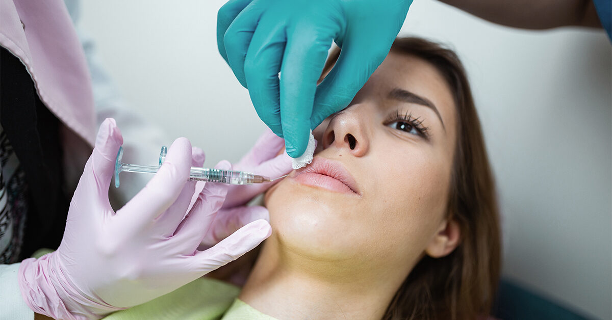 raised acne scar treatment