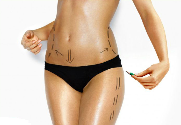 raised acne scar treatment