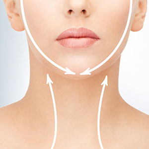 raised acne scar treatment